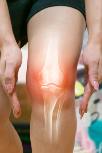 arthrose de la jambe humaine inflammation des articulations osseuses